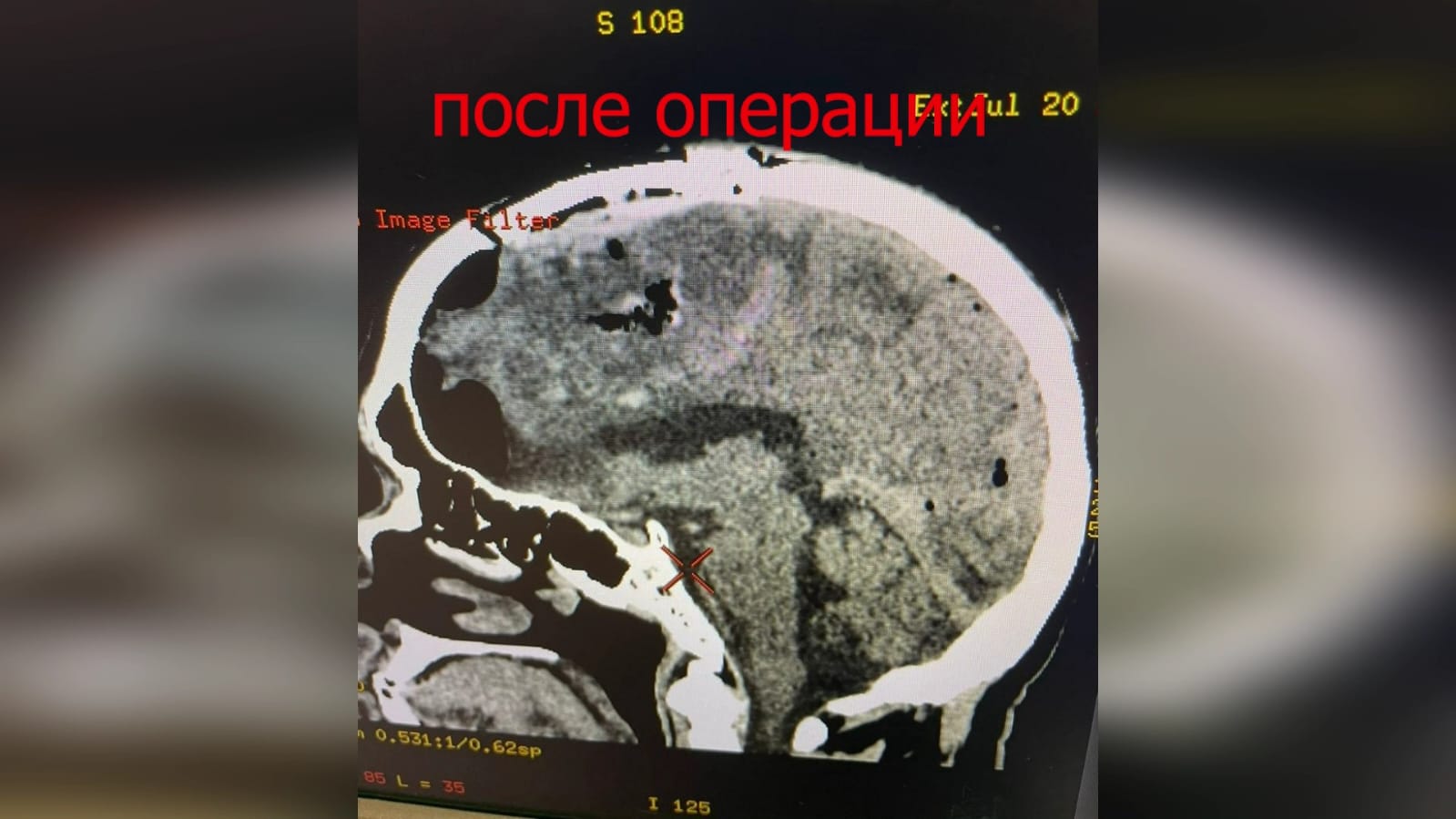 Эксклюзивная гибридная операция: новейший подход